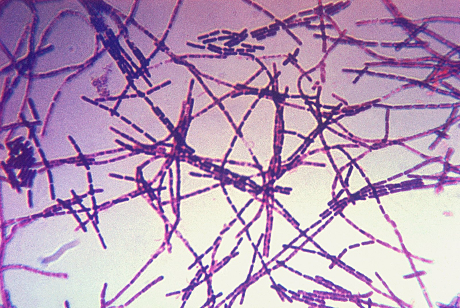 Mikroskopický snímek tyčinkovitých bakterií Bacillus anthracis a jejich odolných endospór